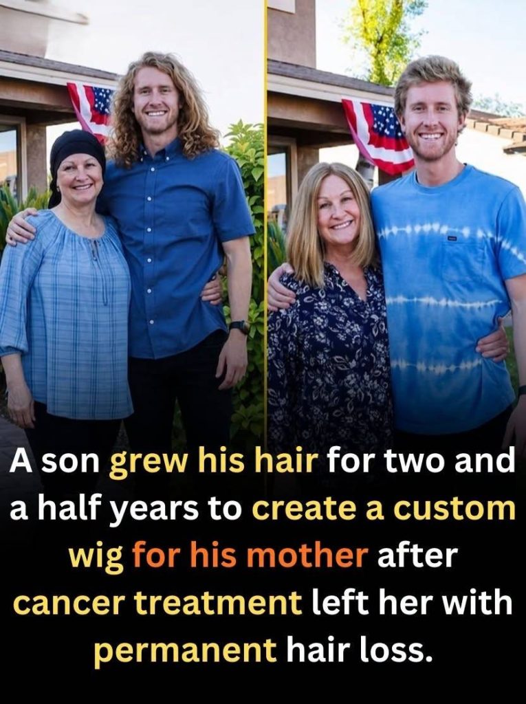 GROW HAIR FOR HIS MOTHER GROW HAIR FOR HIS MOTHER